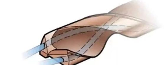 Inner Cooling Design